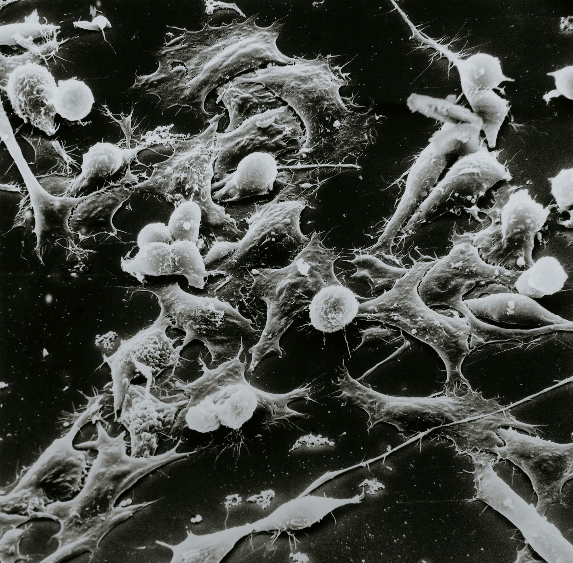 Virotherapy: a future for the fight against cancer?
