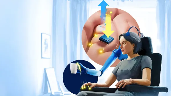 A Revolution in Neuroprosthetics: Restoring Touch with a Brain-Controlled Bionic Hand
