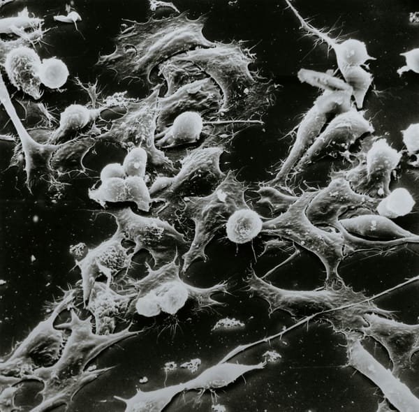 Virotherapy: a future for the fight against cancer?